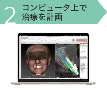 NBPCアセット 16