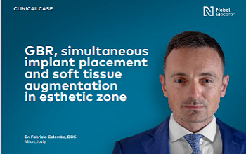 Dr. Colombo - GBR, simultaneous implant placement and soft tissue augmentation in esthetic zone