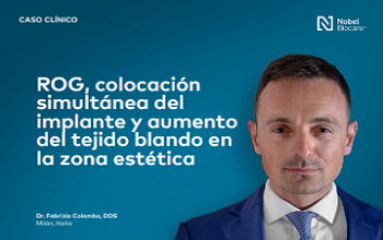 Dr. Colombo - ROG, colocación simultánea del implante y aumento del tejido blando en la zona estética