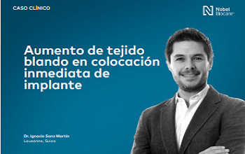 Dr. Sanz Martin - Aumento de tejido blando en colocación inmediata de implante 