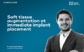 Dr. Sanz Martin - Soft tissue augmentation at immediate implant placement